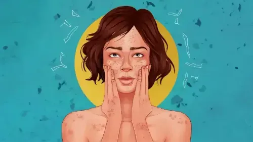 What is Health Insurance for Skin Disorders?